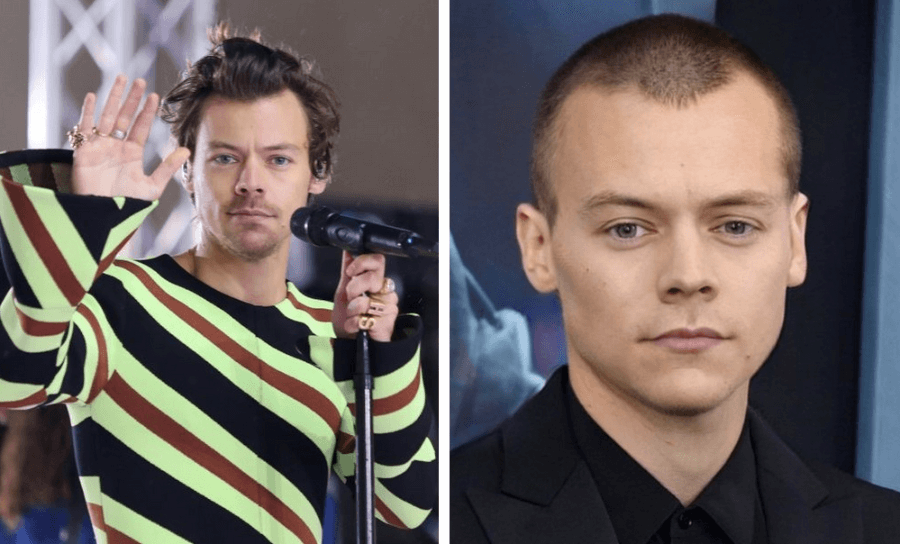 harry styles bald