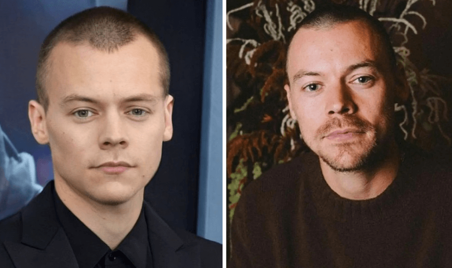 why the bald look could still work for harry